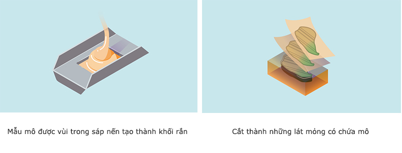 Quy Trinh Lab Giai Phau Benh 4